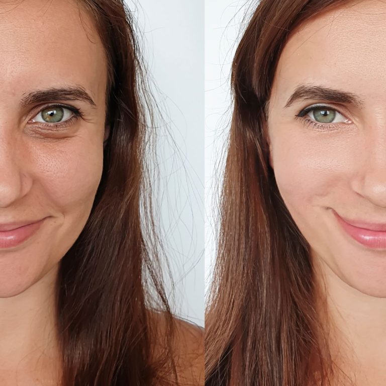 Ojeras