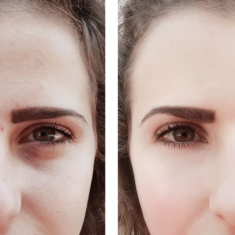 ojeras cansancio belleza